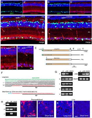 Expression and Roles of the Immunoglobulin Superfamily Recognition Molecule Sidekick1 in Mouse Retina